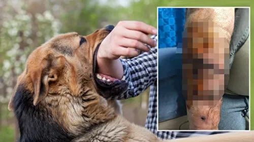 Aksaray'da başıboş köpek dehşeti: 76 dikiş atıldı