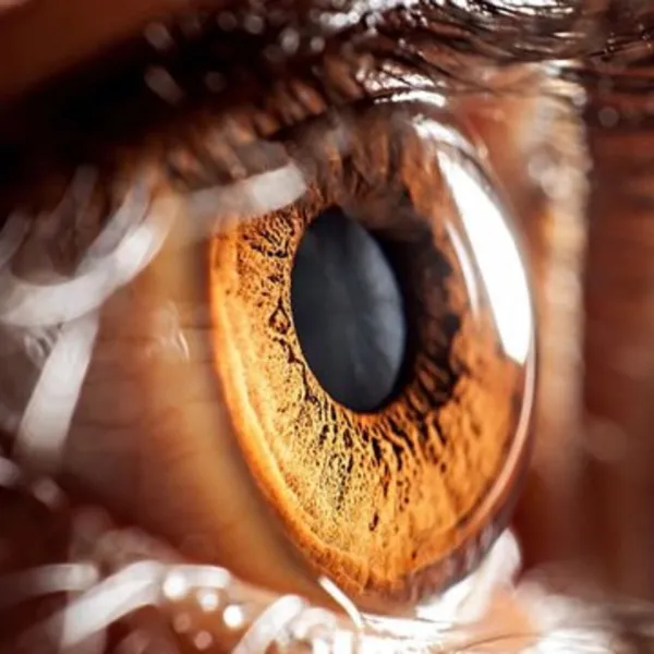 Diyabet Hastaları Dikkat! Göz Sağlığınız Tehlikede mi?